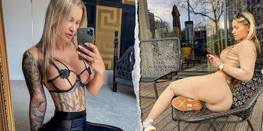 Influencerin l&auml;sst sich Nazi-Tattoo rausschneiden