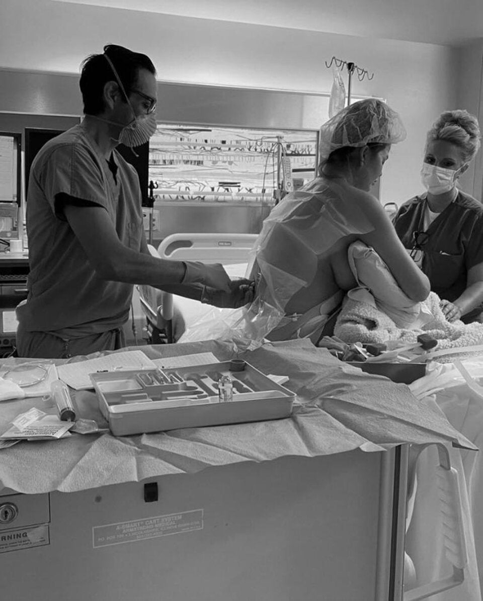 Fehlgeburt: Model Chrissy Teigen hat ihr Baby verloren