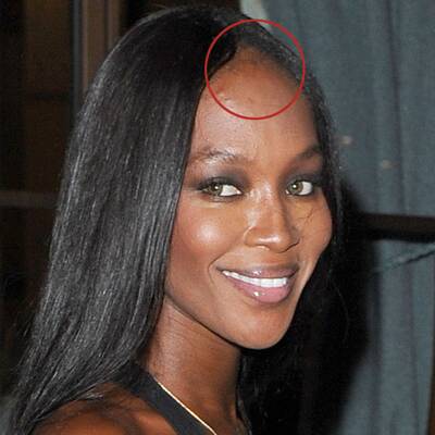 Naomi Campbell: Haar-Probleme
