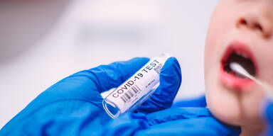 7.514 Neuinfektionen in 24 Stunden in &Ouml;sterreich | Aktuelle Corona-Zahlen