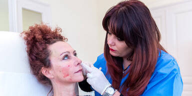 Mausi Lugner: Fadenlifting