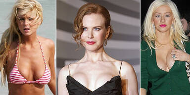 Die 10 misslungensten Brust-OP's