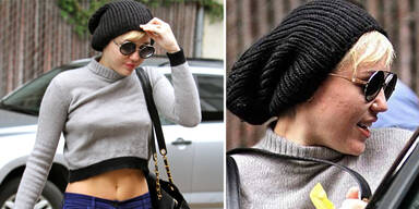 Auch Superstars k&auml;mpfen mit Akne