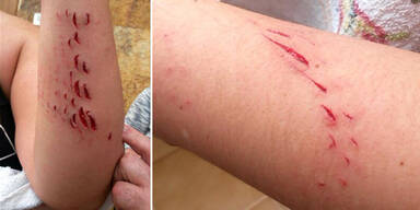 Touristin schl&auml;gt Hai in die Flucht