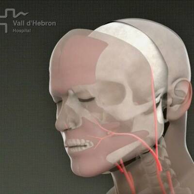 Erste Gesichtstransplantation