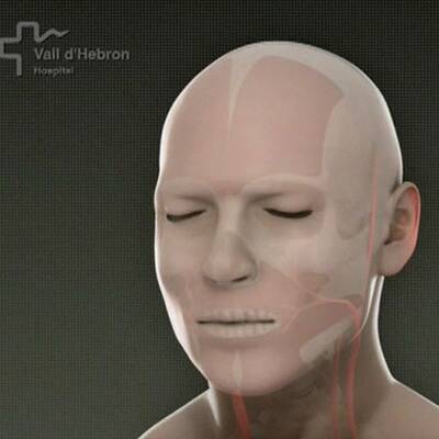 Erste Gesichtstransplantation