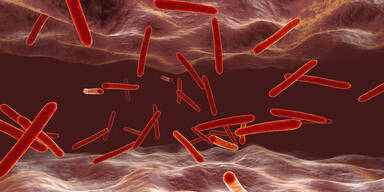 Alarmierende Studie: Experten schlagen Tuberkulose-Alarm