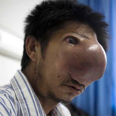 Riesen-Tumor soll bei OP entfernt werden