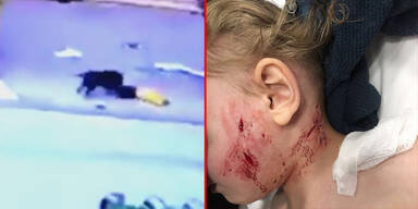 Horror-Video: Pitbull zerfetzt kleinen Buben