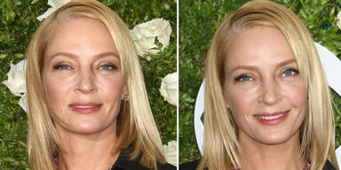 Welcher Star ist hier glatt wie ein Babypo?