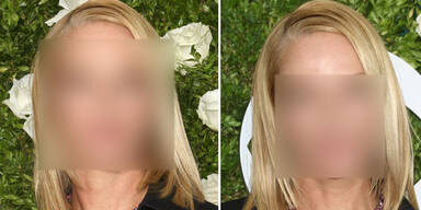 Welcher Star ist hier glatt wie ein Babypo?