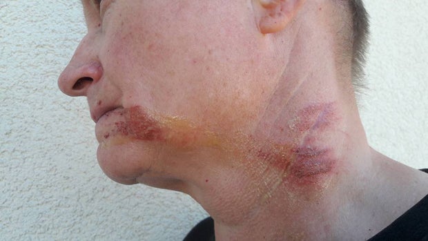 Unfassbar: Schnur über Waldweg gespannt - Reiterin verletzt