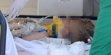 12-jähriger durch Messerstiche verletzt