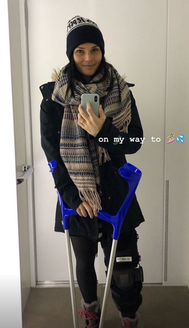 Anna Veith zeigt ihr Horror-Knie