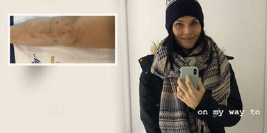 Anna Veith zeigt ihr Horror-Knie