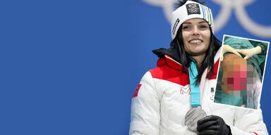 Anna Veith zeigt Schock-Foto von Knie-OP