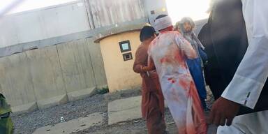 72 Tote bei Anschlag auf Flughafen in Kabul