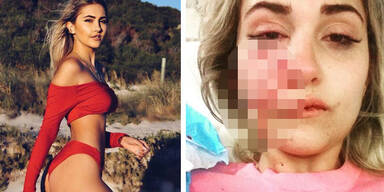Model zeigt Schockfoto nach Hundebissen ins Gesicht