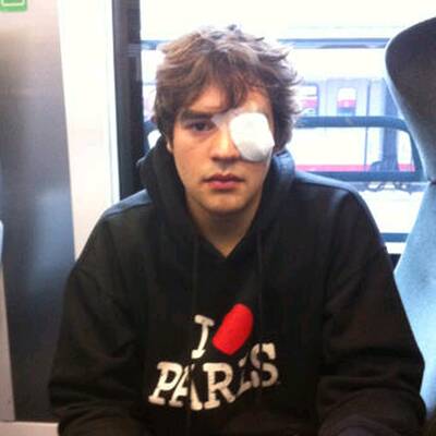 Säure-Attacke auf Tierschützer