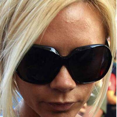 Die Stars mit der schlechtesten Haut