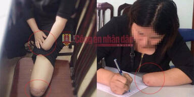 Vietnamesin lie&szlig; sich Hand und Fu&szlig; abhacken