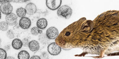 Immer mehr F&auml;lle: Gef&auml;hrliches Virus f&uuml;hrt zu Lungen-Versagen