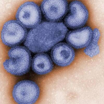 Killer-Virus im Anmarsch