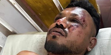 Absturz-Überlebender schildert: "Bei offener Tür hinausgeglitten"