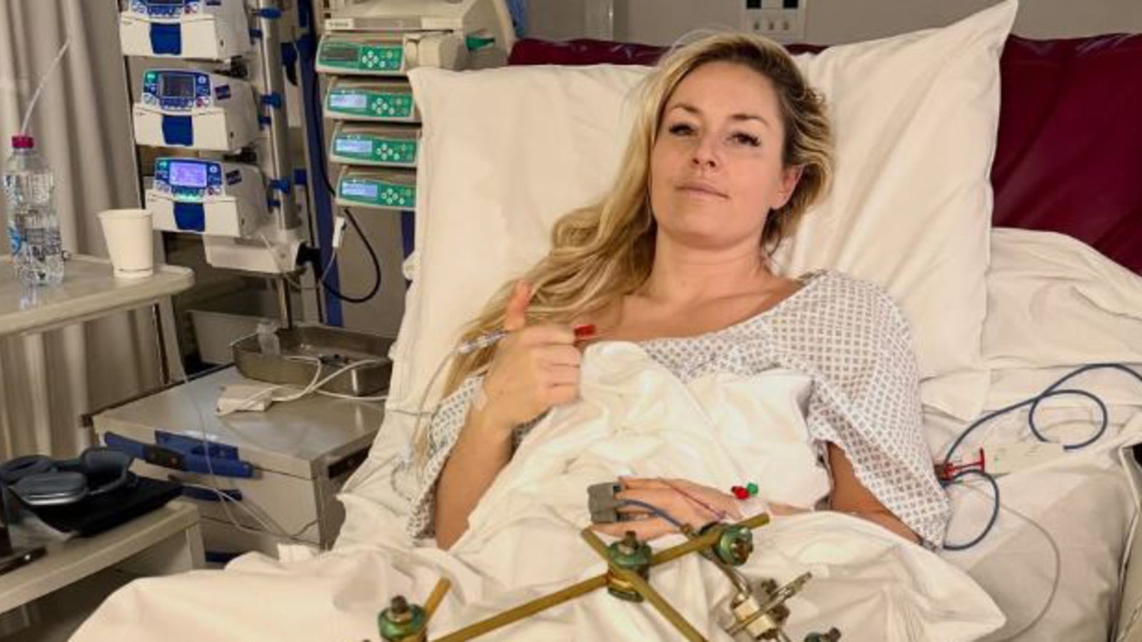 Nach Horror-Sturz: Lindsey Vonn kündigt Ski-Rückkehr an Kép