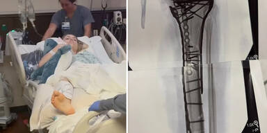 F&uuml;nfte OP bei Lindsey Vonn: "Schmerzen schwer zu ertragen"