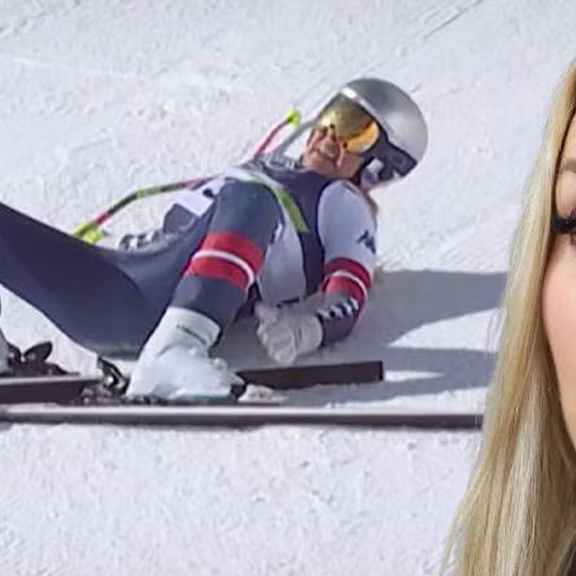 DARUM liegt Vonn nach Horror-Sturz auf der Intensivstation