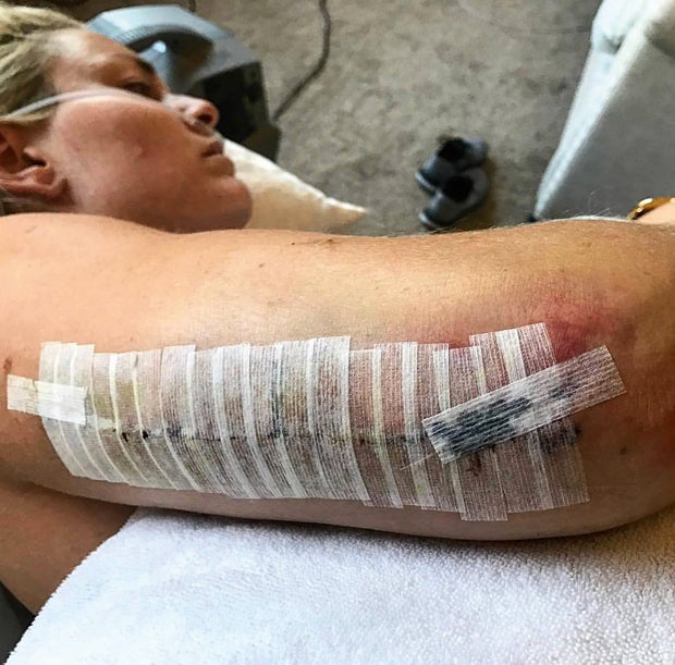 Lindsey Vonns Spitals-Akte