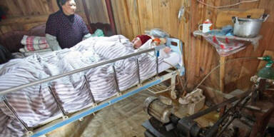 Eltern beatmen Sohn jahrelang mit der Hand