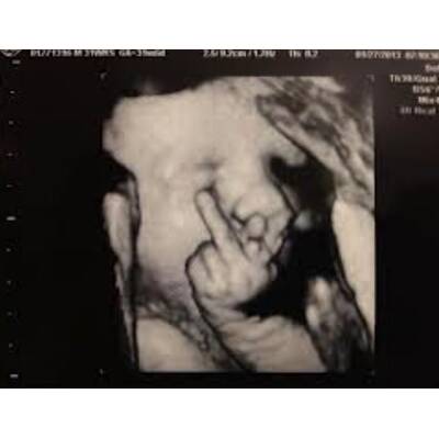 Babys im Bauch: Die witzigsten Bilder