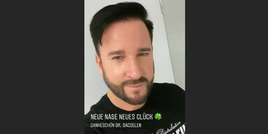 Wendler: Neue Nase trotz Megapleite