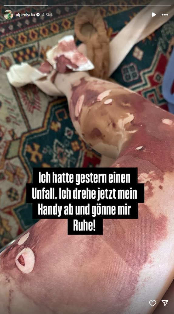 Lydia Kelovitz nach ihrem Unfall