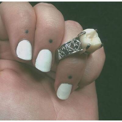 Weißheitszahn als Verlobungsring 