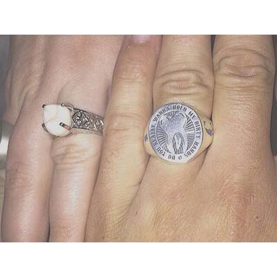 Weißheitszahn als Verlobungsring 