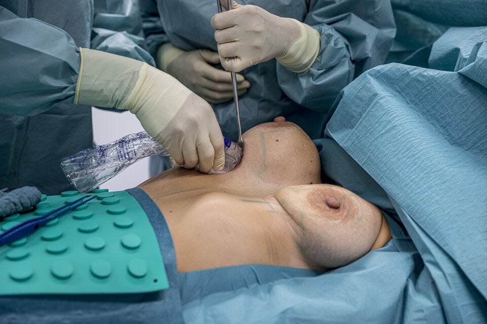 Mommy Makeover: Die ''Reparatur'' nach der Schwangerschaft