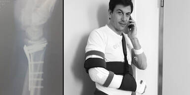 Schwerer Radunfall von Mercedes-Boss Wolff