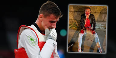 Jack Woolley zusammengeschlagen und blut&uuml;berstr&ouml;mt