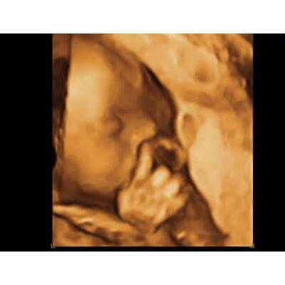 Babys im Bauch: Die witzigsten Bilder