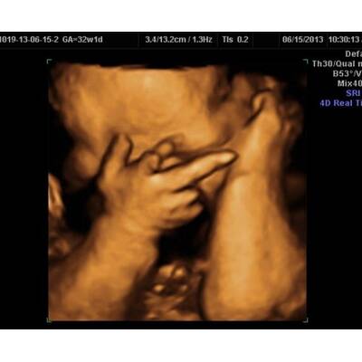 Babys im Bauch: Die witzigsten Bilder