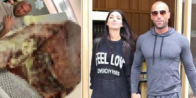 Bastian Yotta schockt mit OP-Wunde