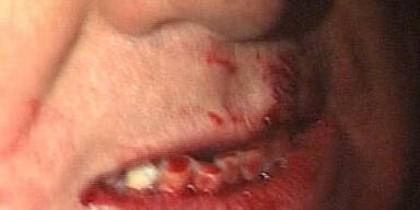 Berlusconi kann kaum etwas essen