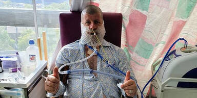 Mann geht 27 Jahre nicht zum Zahnarzt: Kiefer entfernt