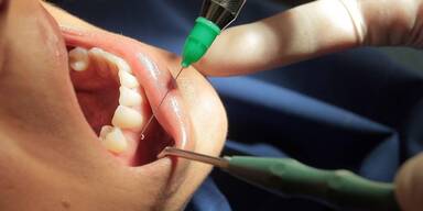 O&Ouml; droht Mangel an Zahn&auml;rzten