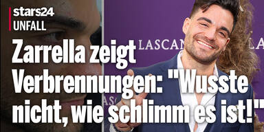 Unfall! Stefano Zarrella zeigt Verbrennungen: 