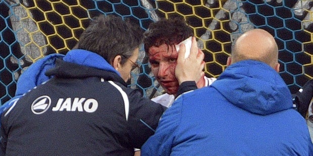 Verletzungs-Schock um Altach-Profi