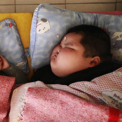 Neue Fotos vom dicksten Kind der Welt